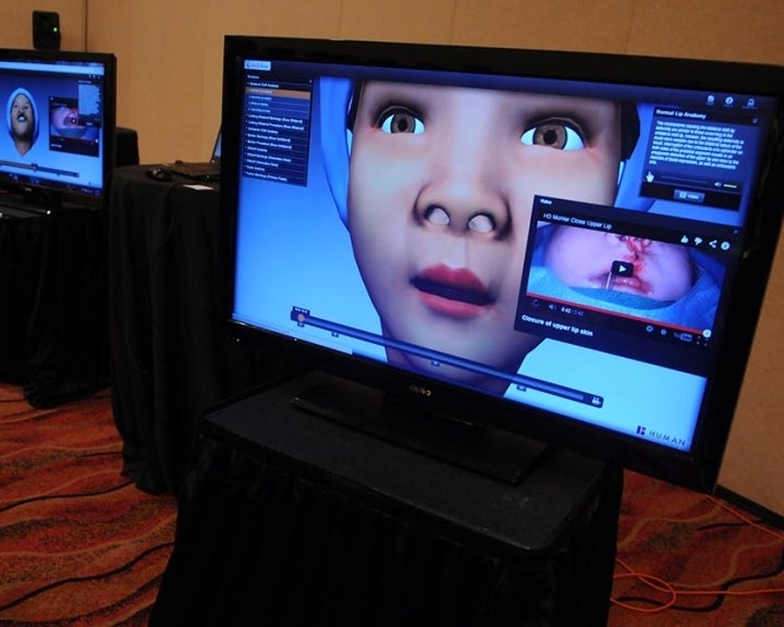virtual surgery simulator