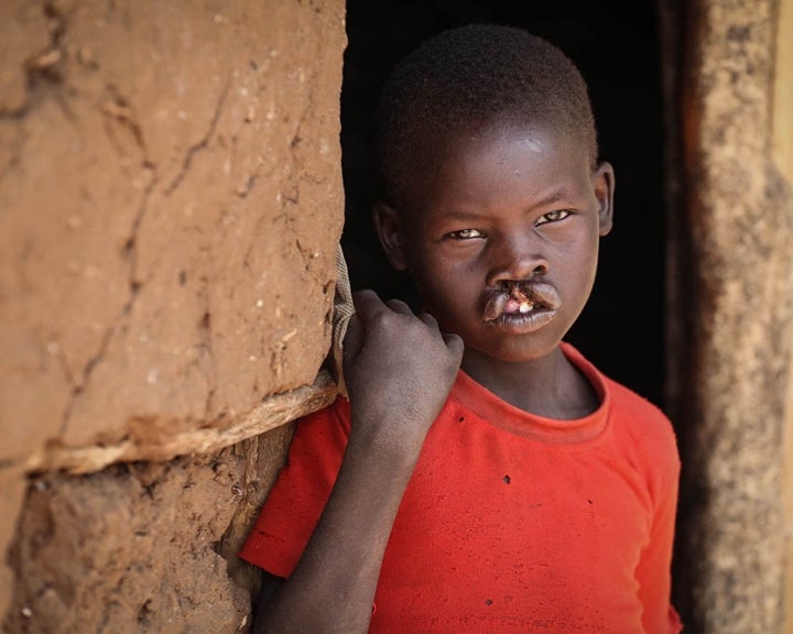 boy is isolated with cleft lip